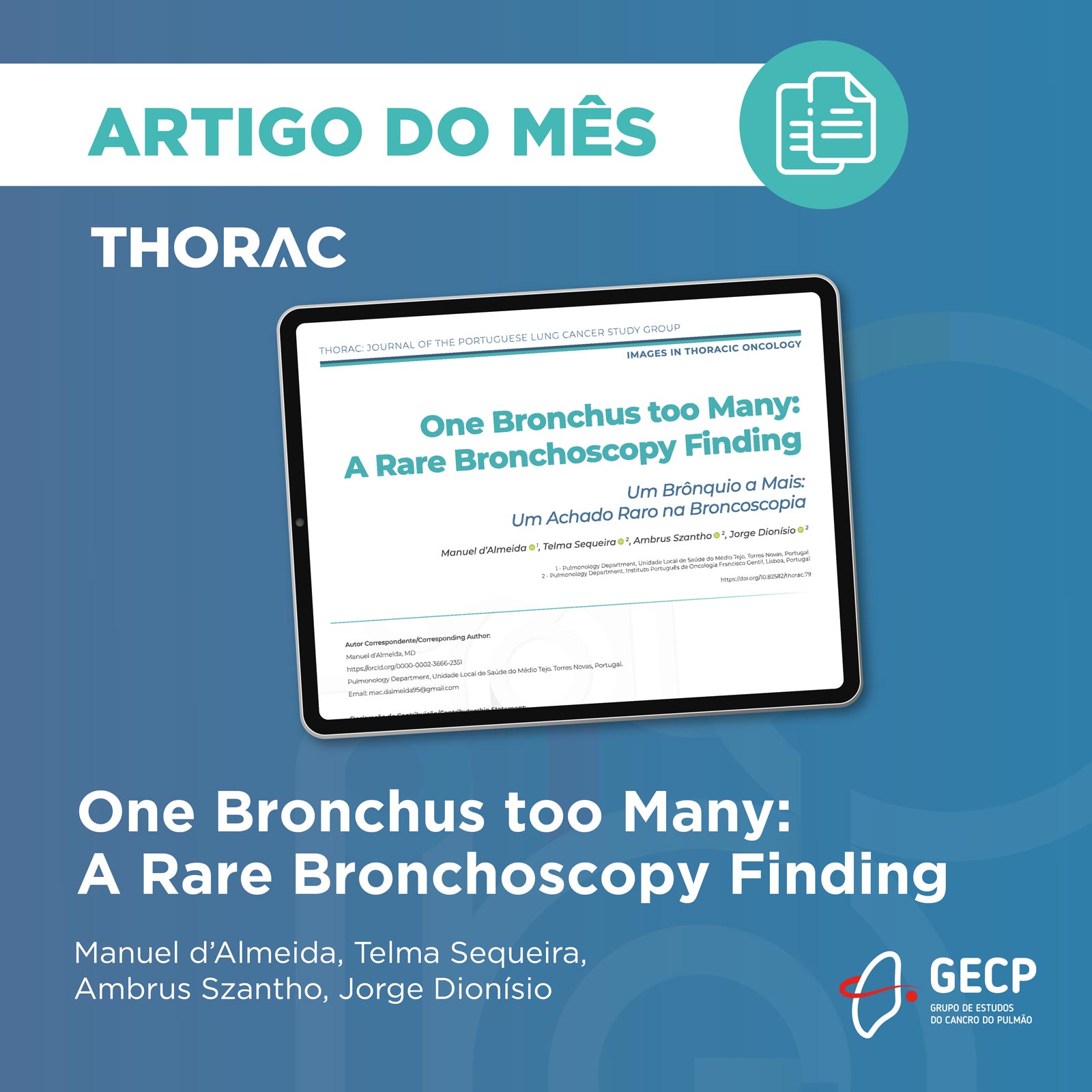 Conheça o artigo do mês de julho da THORAC Conheça o artigo do mês de julho da THORAC